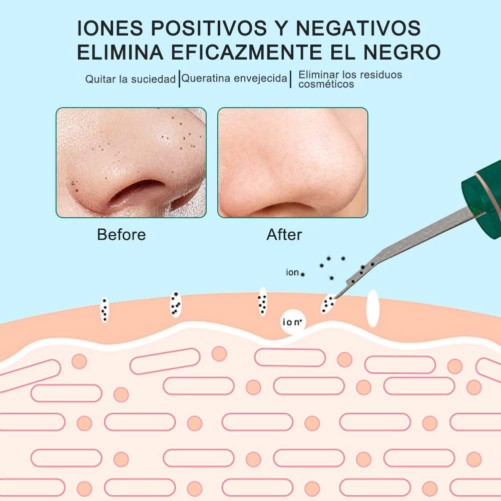 LIMPIADOR FACIAL ULTRASÓNICO
